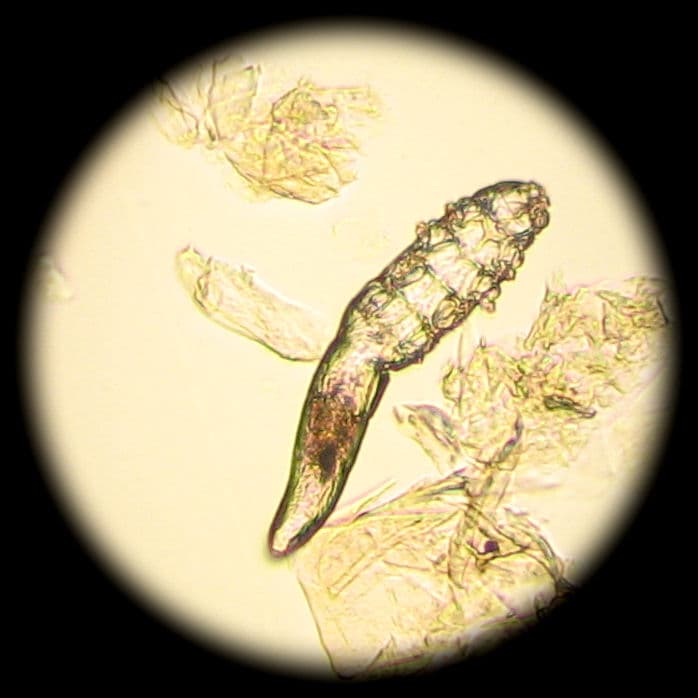 What kills human demodex mites?