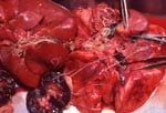 heartworms