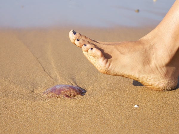 jellyfish on beach, step on jellyfish, dog hurt by jellyfish