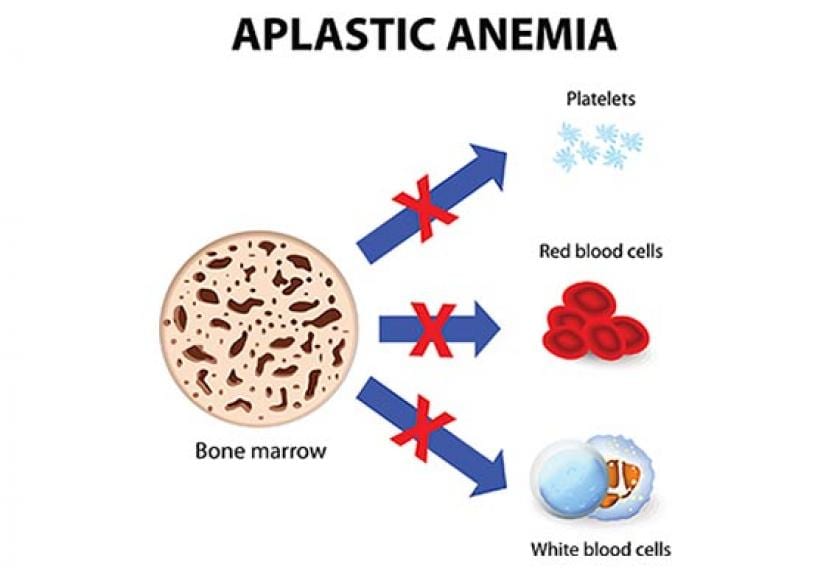 Sudden Anemia in Dog Long Term Anemia in Dog Treatment for Anemia
